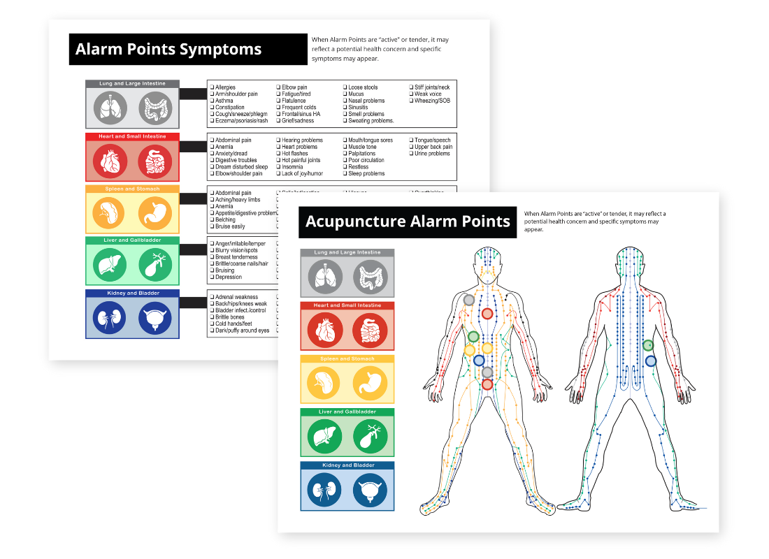 Ashi - Alarm Points Chart - ProdShot